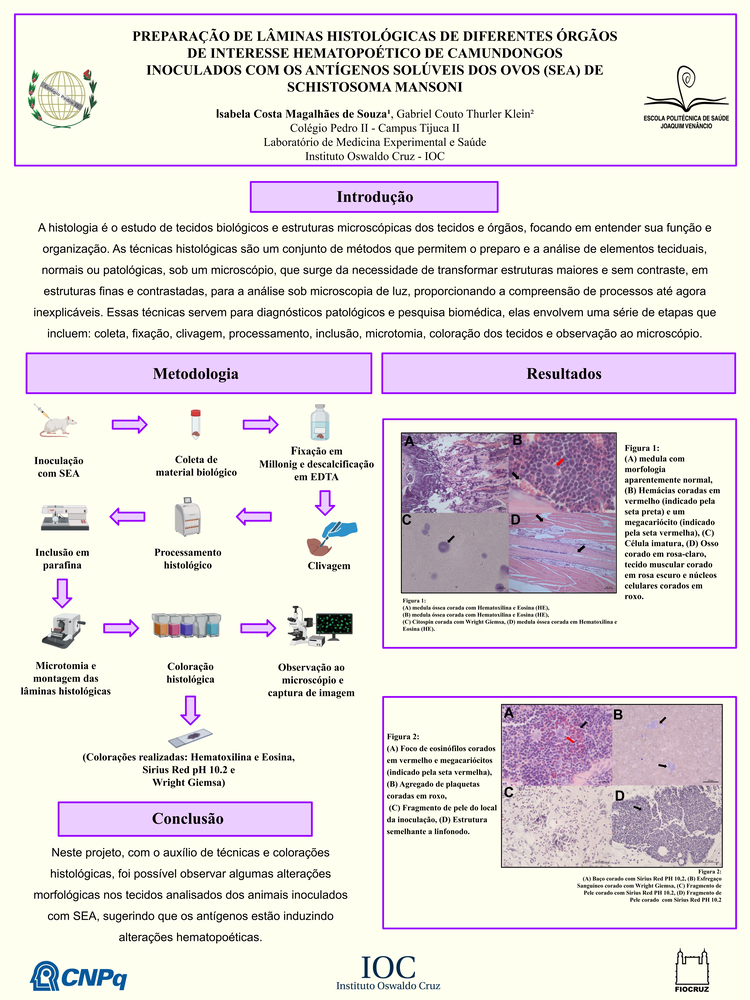 Pôster apresentado pela estudante Isabela Costa Magalhães de Souza sob orientação do pesquisador Gabriel Couto Thurler Klein: Preparação de lâminas histológicas de diferentes órgãos de interesse hematopoético de camundongos inoculados com os antígenos solúveis dos ovos (sea) de schistosoma mansoni.