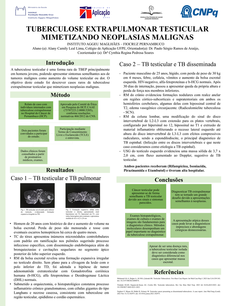 Pôster apresentado pela estudante Alany Camily Leal Lima sob orientação do pesquisador Paulo Sérgio Ramos de Araújo: Tuberculose extrapulmonar ovariana mimetizando neoplasias malignas.