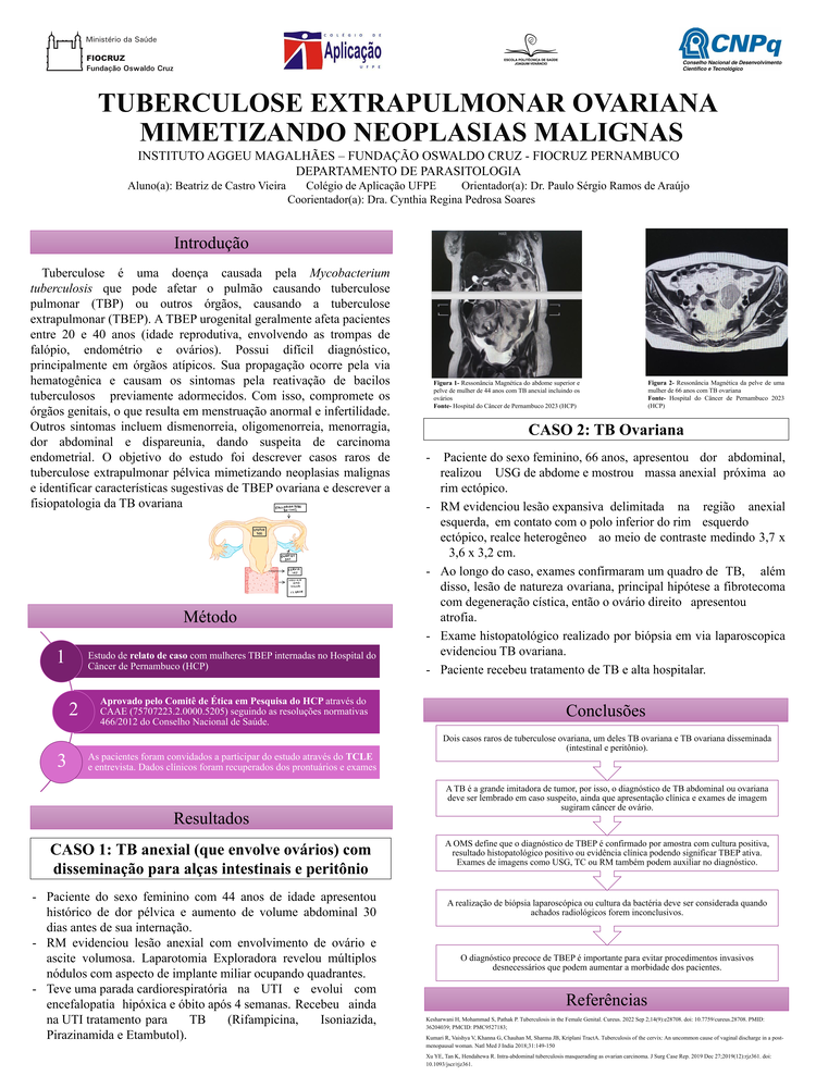 Pôster apresentado pela estudante Beatriz de Castro Vieira sob orientação do pesquisador Paulo Sérgio Ramos de Araújo: Tuberculose extrapulmonar ovariana mimetizando neoplasias malignas.							